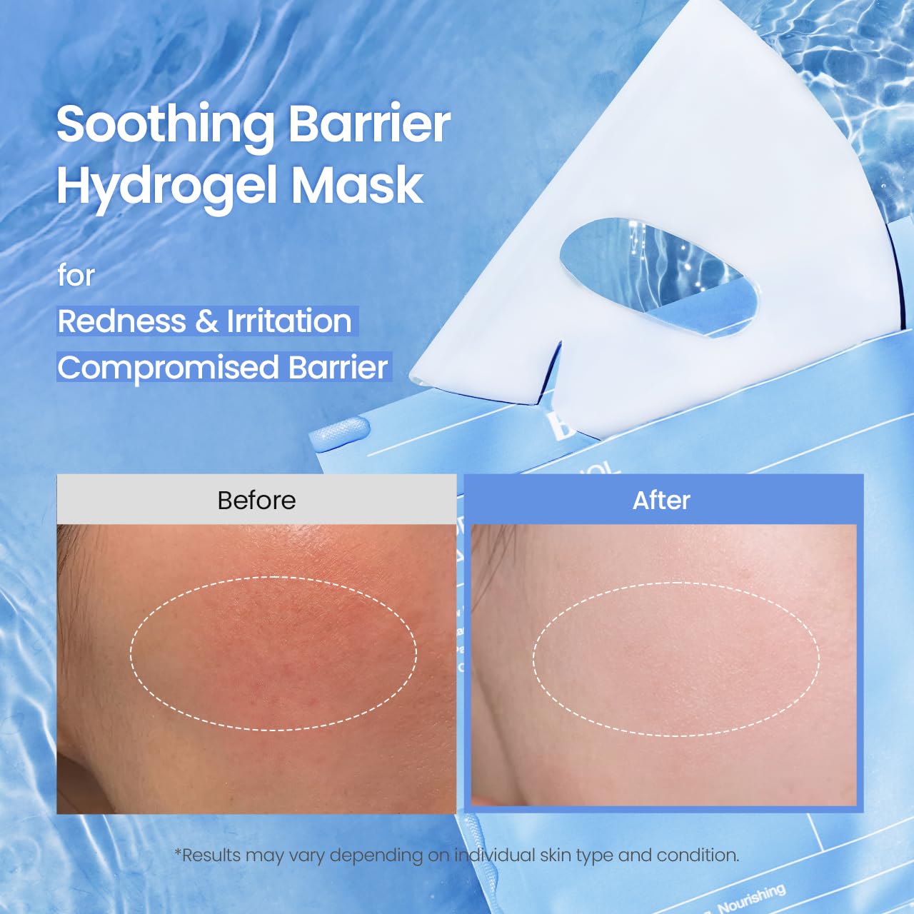 BIODANCE Hydro Cera-nol Real Deep Mask, Overnight Hydrogel Mask, Hydrating Facial Mask For Sensitive Skin, Redness Reducing & Quick Soothing Effect, Korean Skincare, Stocking Stuffers |